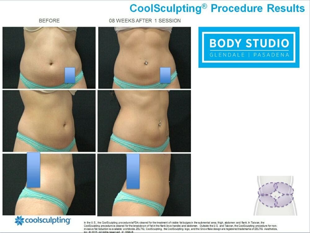 Glendale Body Studio