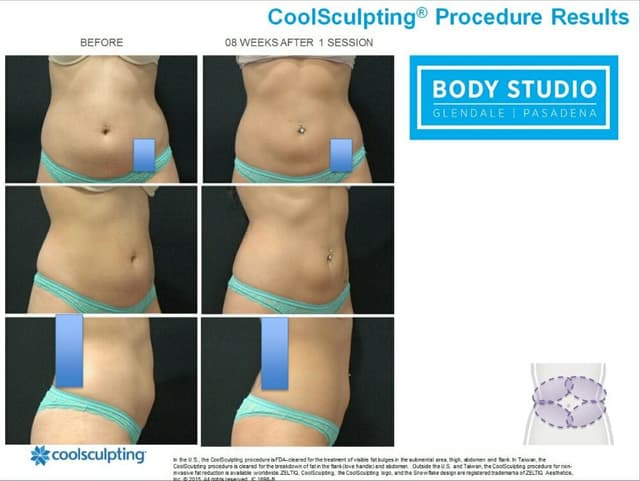 Glendale Body Studio